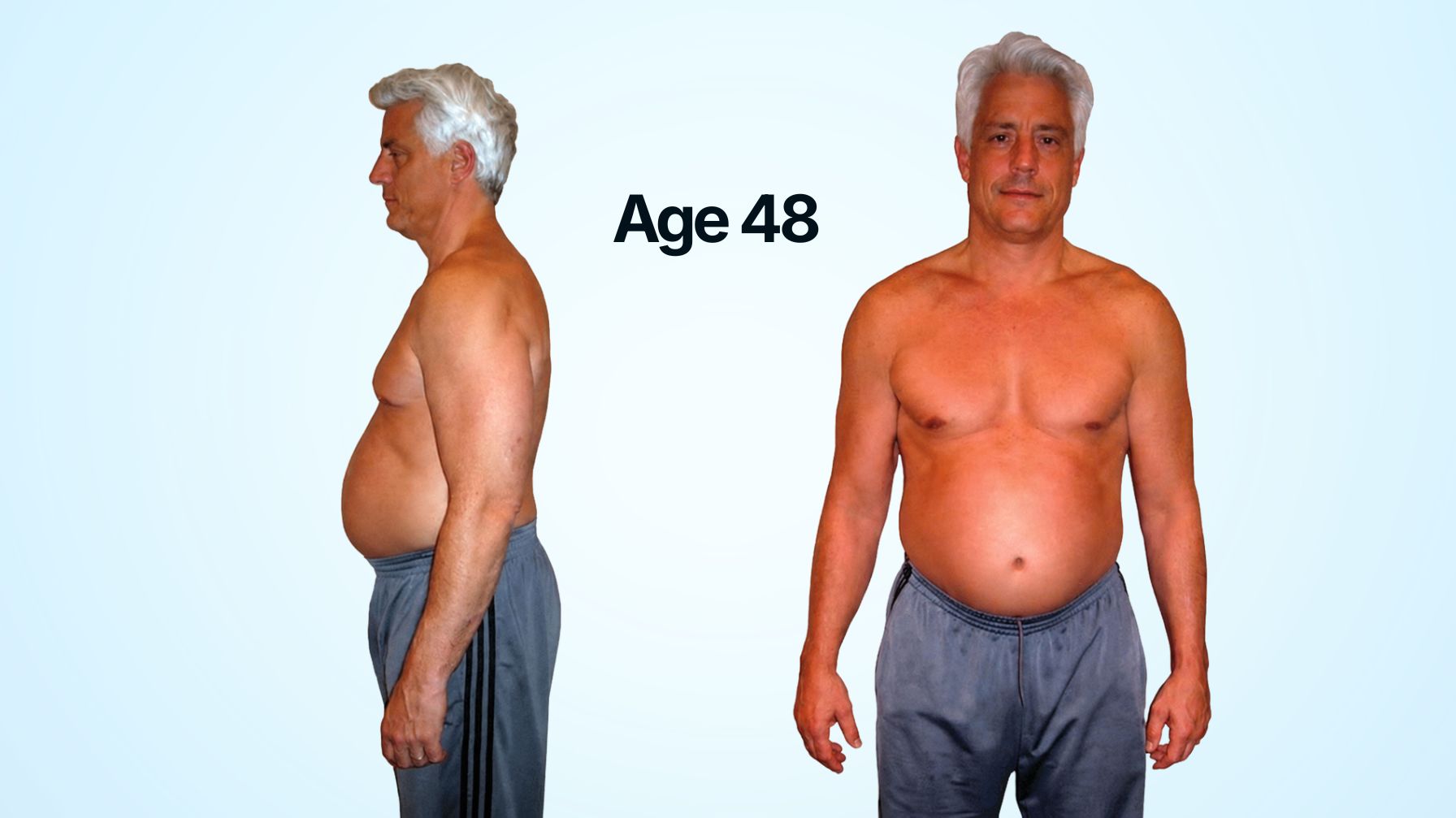 Dr. Anthony Lauro age 48 before transformation